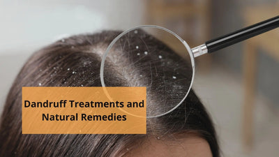 Dandruff Treatments and Natural Remedies